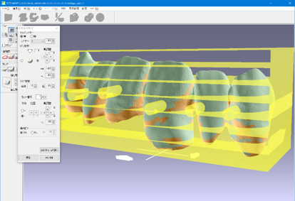 ＜歯科用CAD/CAMシステム＞DORA Plus / WAXY Plus