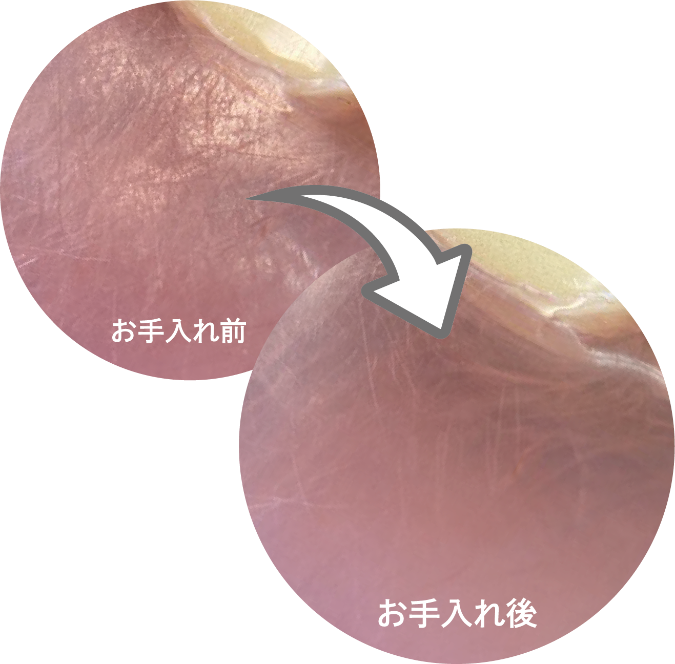 ＜患者用義歯研磨剤＞入れ歯のキズ取りクリーム